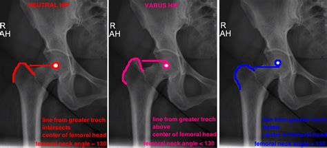 Anatomy — Hip And Knee Book
