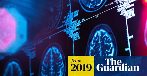 Womens Brains Are Four Years Younger Than Mens Study Finds
