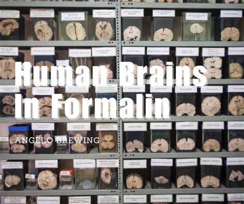 Why Danish University Keep About Human Brains In Formalin