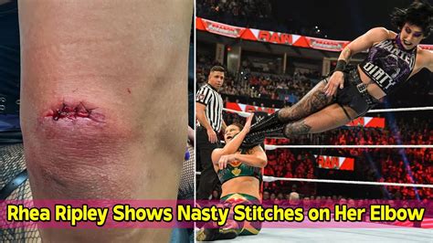rhea ripley shows nasty stitches on her elbow following brutal match with shayna baszler youtube