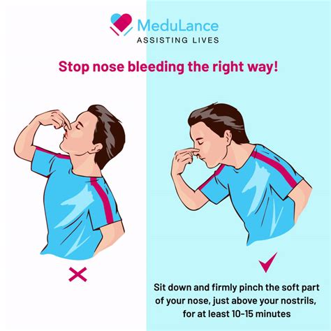 Most Of Us Use The Wrong Technique To Stop Nose Bleeding Which Can Actually Make The Situation