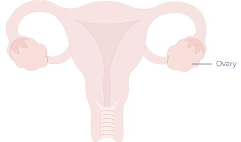 Ovarian Cancer Signs And Symptoms Diagnosis Treatment