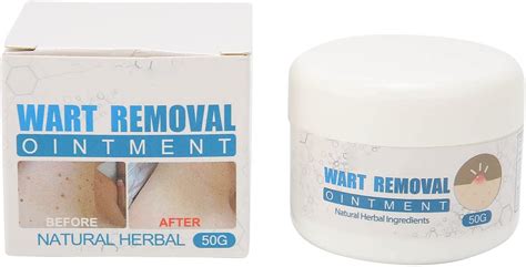 50g Wart Removal Cream Wart Treatment Lotion For Face Body Skin Easy