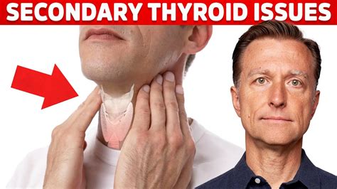 Most Thyroid Issues Are Secondary To Other Problems Dr Berg Youtube