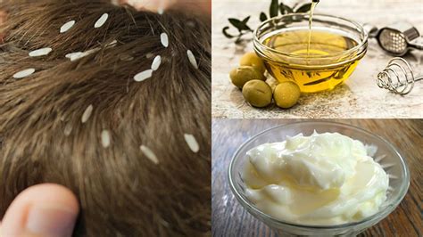 6 Home Remedies To Treat Head Lice Naturally Best Herbal Health