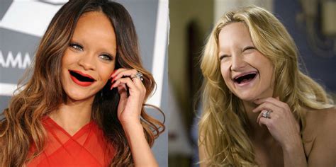 15 Weird Af Photos Of Hot Celebs Without Teeth Therichest