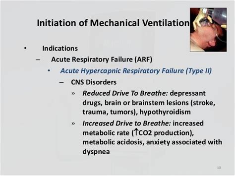 Mechanical Ventilation Ppt Acute Respiratory Failure Respiratory