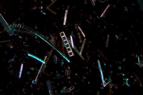 Diatoms 100x Magnification Darkfield Is A Magnificent Set Flickr