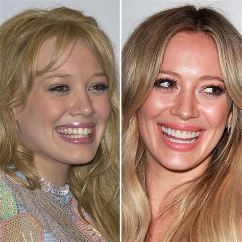 Teeth aren't actually supposed to be really white and many whitening toothpastes aren't recommended by most dentists because most of them damage enamel i really like to take care of my teeth. Real Stars, Fake Teeth: 20 Celebrities Who Have Had ...