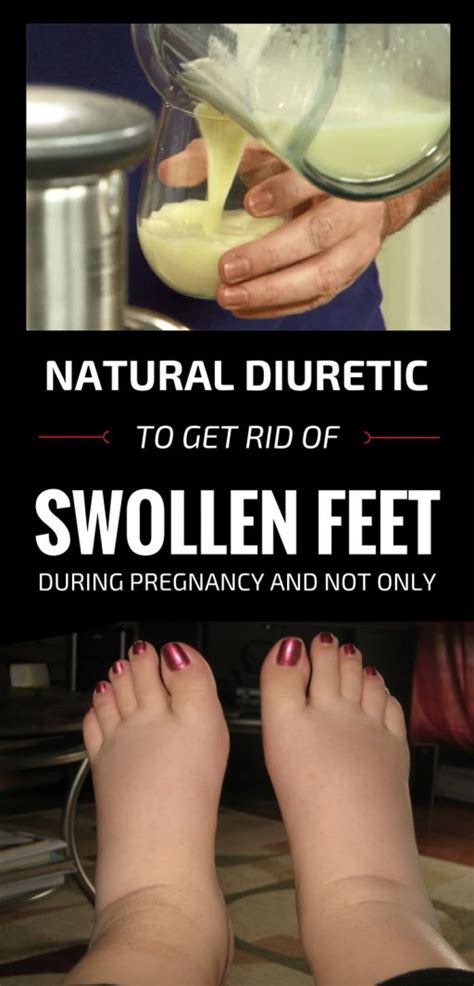 Natural Diuretic To Get Rid Of Swollen Feet Swollen Feet Swollen