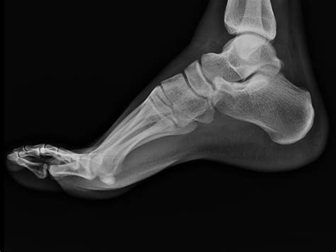 Foot Advanced Radiology