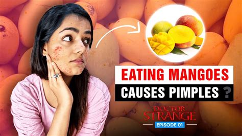 Does Mango Causes Pimples 🥭 Doctor Strange Ep 1 Youtube