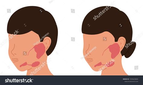 Localization Salivary Glands Males Females Medical Stock Vector