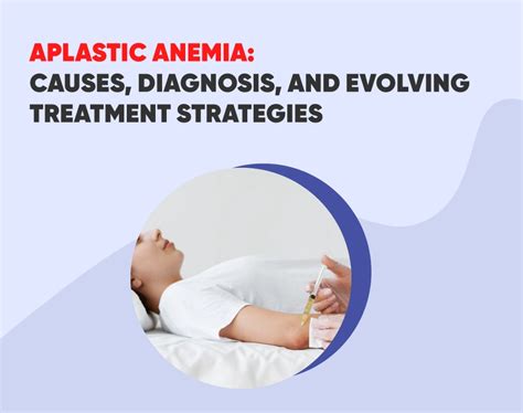 Aplastic Anemia Causes Diagnosis And Evolving Treatment Strategies