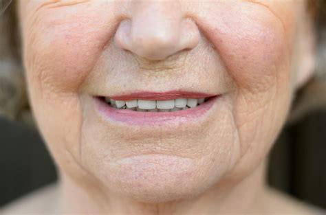 4 Different Types Of Wrinkles And How Tcm Can Treat Them