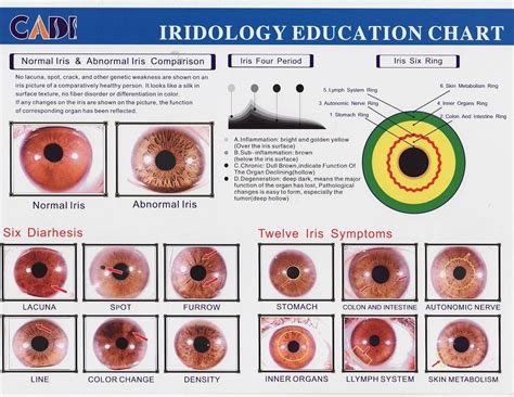 Iridology Eye Chart Diagnosis Maikong Iridology Cameras And Iriscope