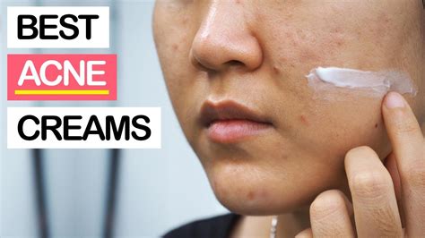 Acne Treatment Best Cream For Acne