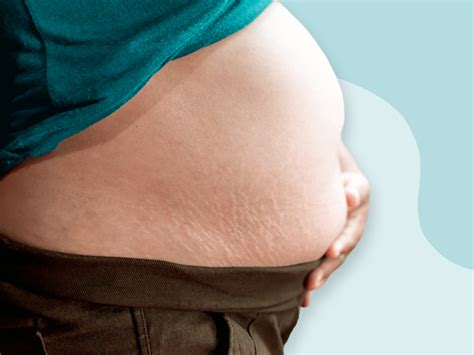 We did not find results for: What Is a B Belly During Pregnancy and Why Does It Happen?