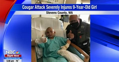 Cougar That Attacked 9 Year Old Girl Tests Negative For Rabies Wdfw Provides Details Of The