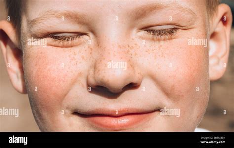 Little Kid With Furious Blue Eyes For Childhood Rebellion Freckle