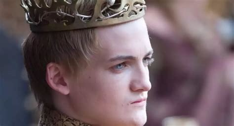 El Rotundo Cambio F Sico Del Actor Que Interpret A Joffrey Baratheon