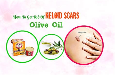 13 Tips How To Get Rid Of Keloid Scars On Ear Nose Chest Neck Back