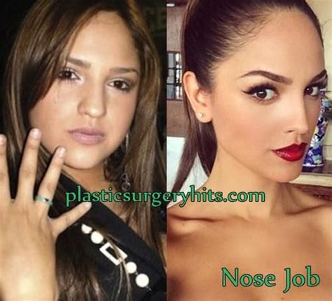 Eiza Gonzalez Plastic Surgery Before And After Plastic Surgery Nose