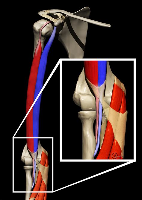 Distal Biceps Tendon Rupture Elbow Radsource
