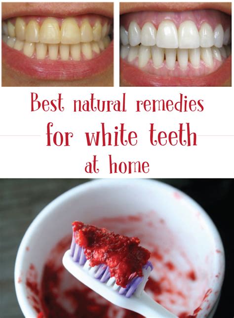 Best Natural Remedies For White Teeth At Home Fit Db