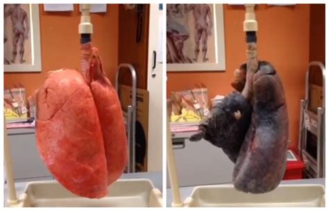 TomiwaTV: The lung capacity of a smoker vs a non-smoker.