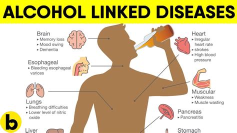 Alcohol Can Cause These 5 Serious Diseases Sports Health And Wellbeing