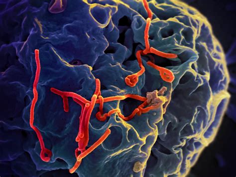 Dod Medical Countermeasures Find Use In Ebola Outbreak Us