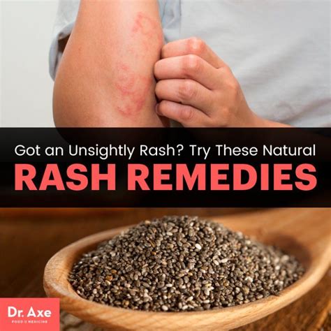 How To Get Rid Of A Rash 6 Natural Rash Remedies Natural Rash