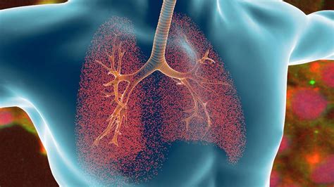 Researchers Are Studying The Treatment Of Cystic Fibrosis With Tmem16a