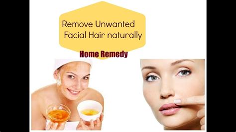 Some of the recipes may remove the unwanted hair permanently. DIY How to remove facial hair naturally at home- Remove ...