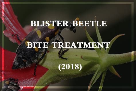 Blister Beetle Blister Beetle Bite Treatment 2018 Pest Wiki