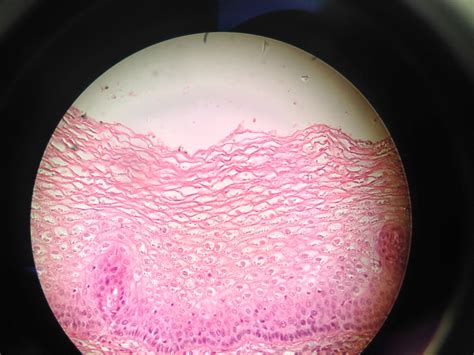 Non Keratinized Stratified Squamous Epithelium Medium Flickr