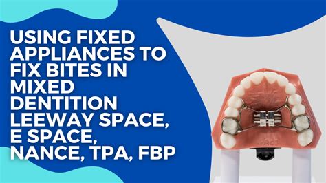 Using Fixed Appliances To Fix Bites In Mixed Dentition Leeway Space E