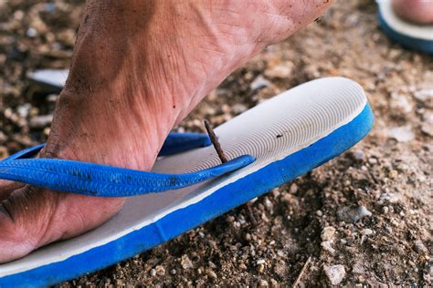 11 Reasons You Should Never Wear Flip Flops The Healthy