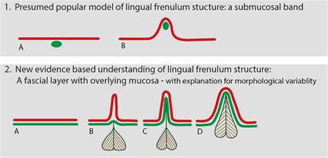 Anatomically Based Understanding Of Lingual Frenulum Structure Diagram
