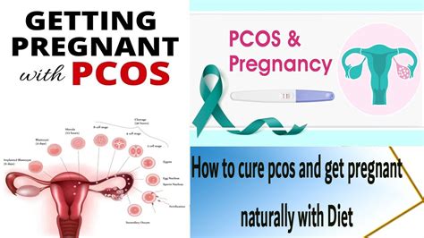 How To Cure Pcos With Diet Naturally And Get Pregnant Pcos Diet Plan