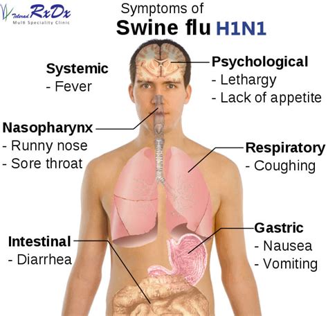 H1n1 Swine Flu Causes Signs Symptoms Diagnosis And Treatment Rxdx Healthcare