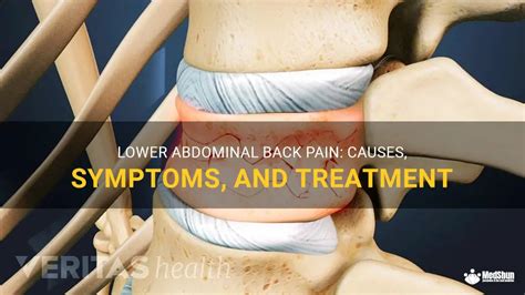 Lower Abdominal Back Pain Causes Symptoms And Treatment Medshun