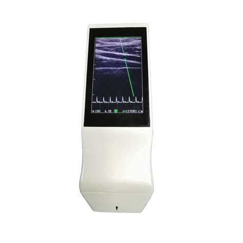 El Mini Escáner Portátil Del Ultrasonido De Doppler Del Color De La