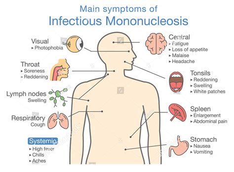 Infectious Mononucleosis Causes And Mode Of Transmission