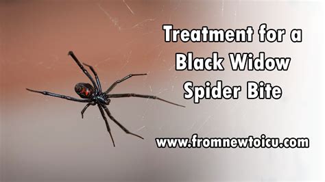 Black Widow Bite Treatment — From New To Icu