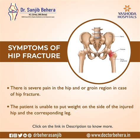 Symptoms Of Hip Fractures Hip Fracture Orthopedics Symptoms