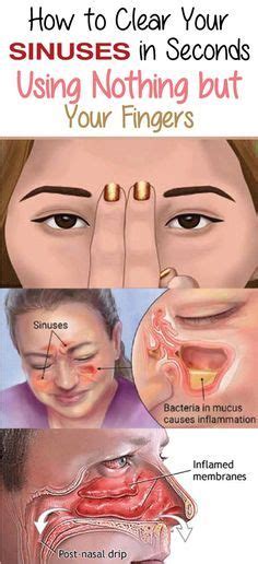 Blocked Sinuses Are A Common Problem For People Of All Ages It Is