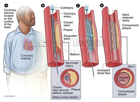 Heart And Coronary Artery Diseases Link Studio