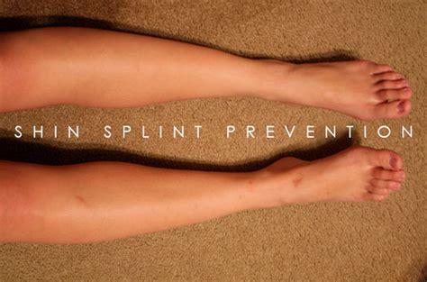 Shin Splint Prevention